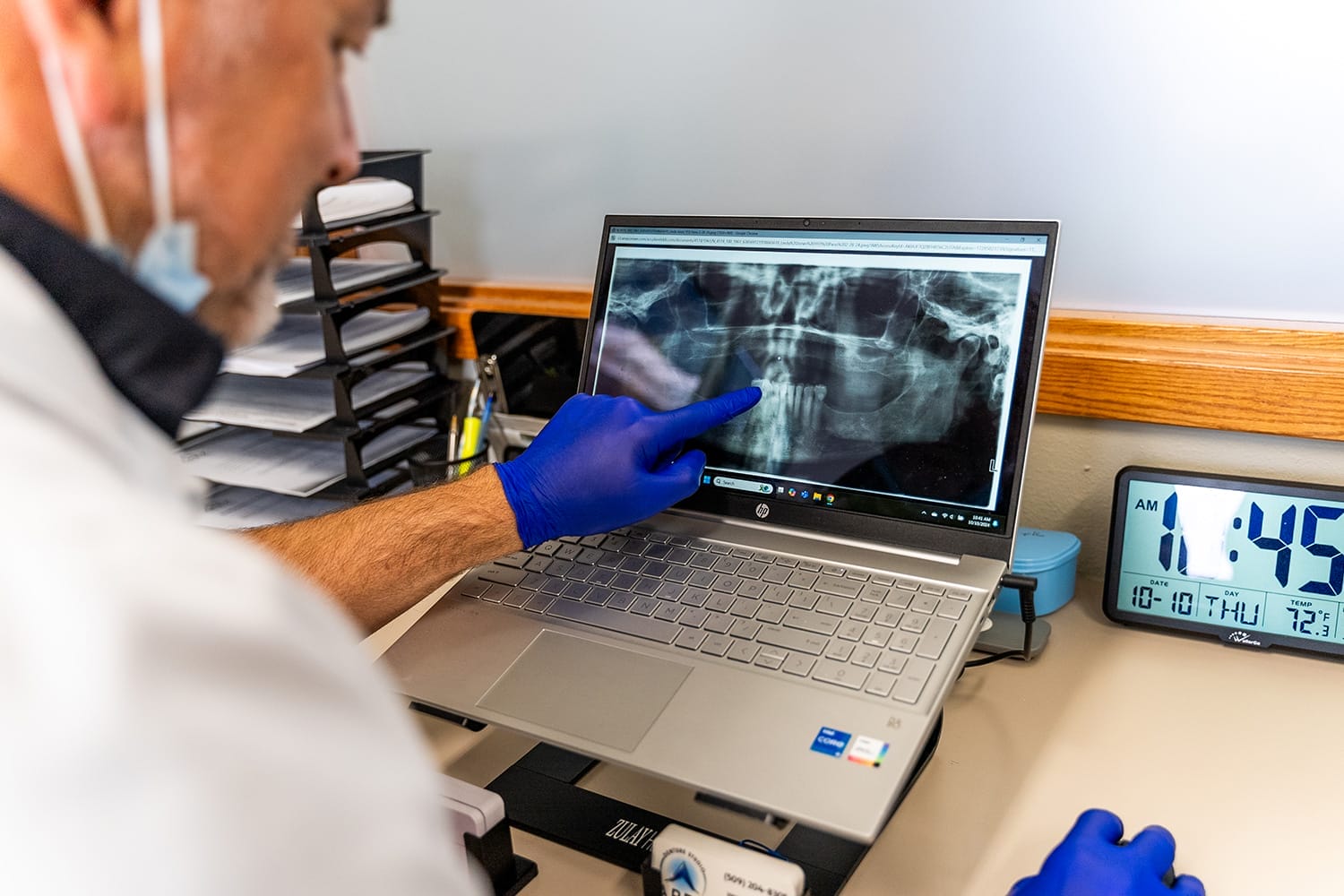 doctor-looking-at-mouth-xray denturist pointing to X-ray on a computer
