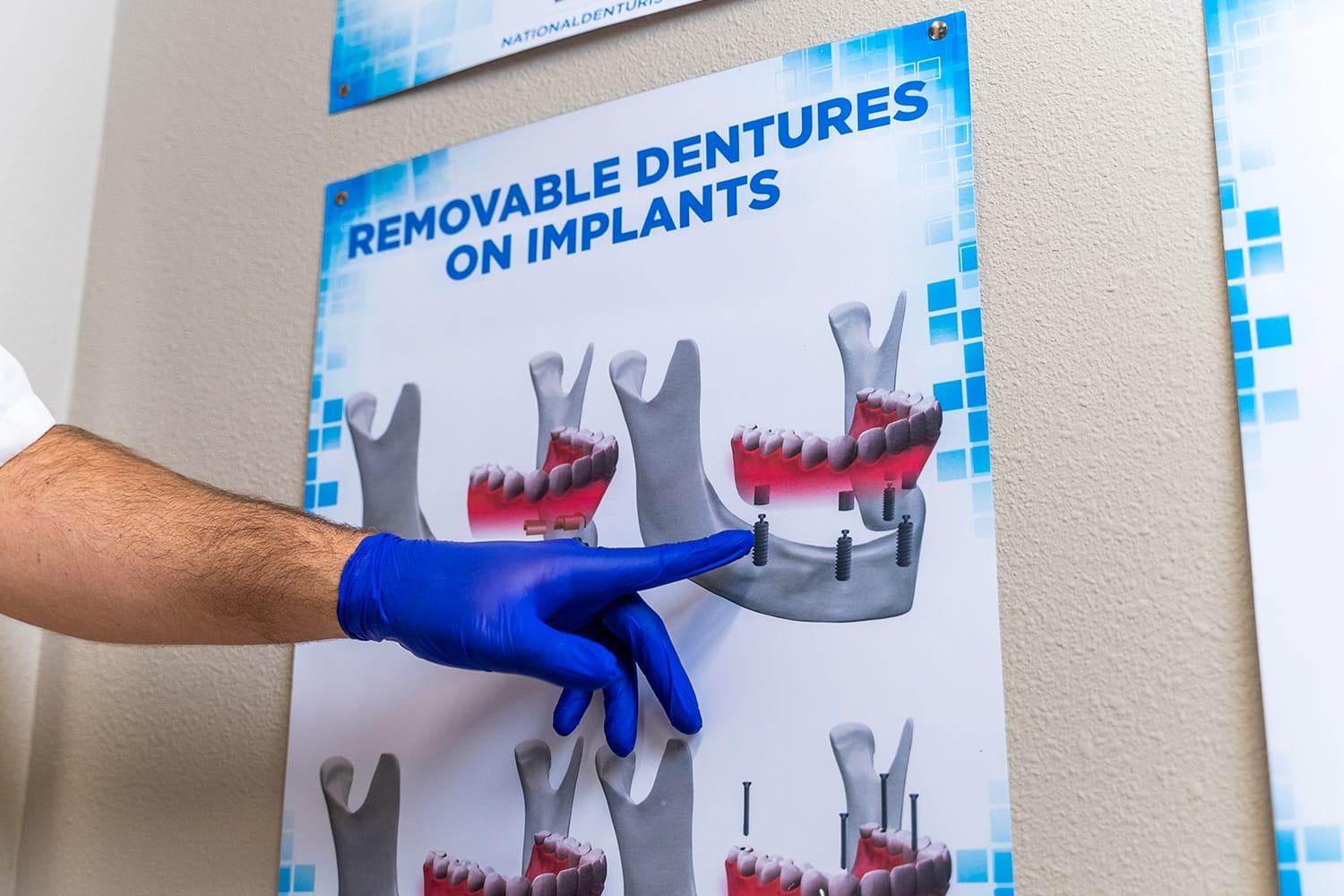 doctor-pointing-out-dentures-poster denturist explaining implant-retained dentures